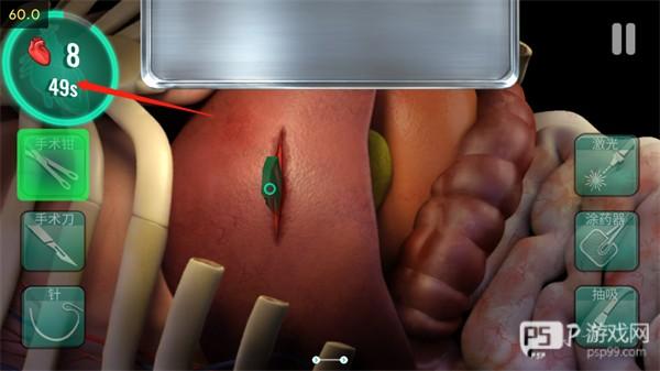 医院手术时间游戏汉化版截图9